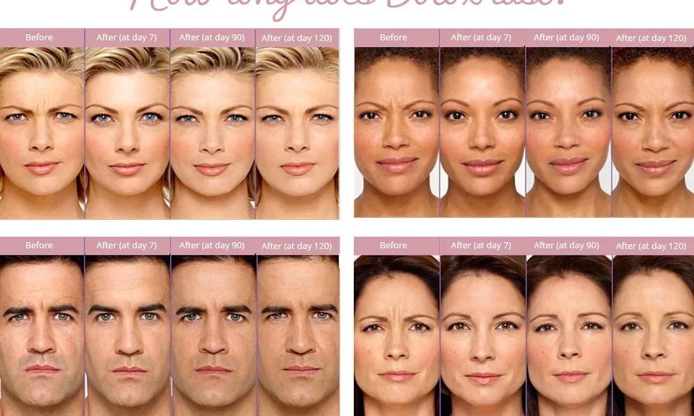 Erome: Exploring the Platform, Features, and Online Privacy Concerns