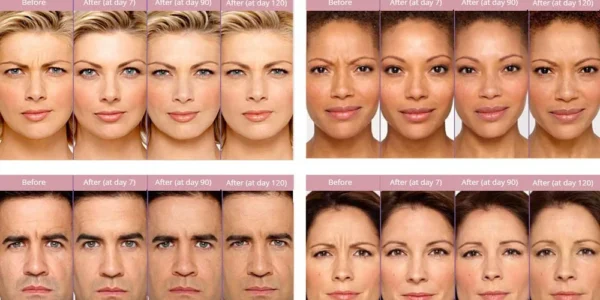 Erome: Exploring the Platform, Features, and Online Privacy Concerns